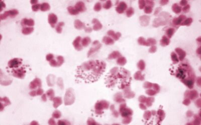 STIs through the centuries