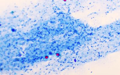 What is cryptosporidium, and how can you avoid it in the water or on the farm?