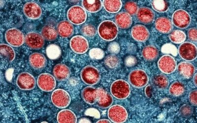 Mpox clade 1: what you need to know